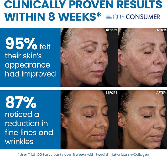 Swedish Nutra - Hydrolyzed Marine Collagen Liquid Supplement - Pack of 500 ml, 20 Day Supply | Pure Peptide and Vitamins for Healthy Hair, Skin, Nails and Joints I 100% Natural Berry Flavour